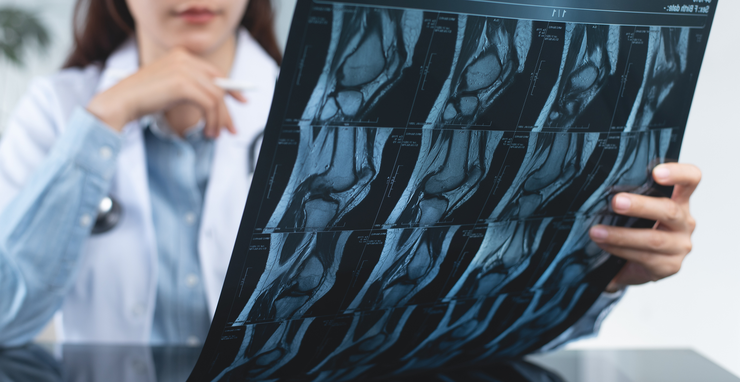 How to Understand Your Knee MRI Results?