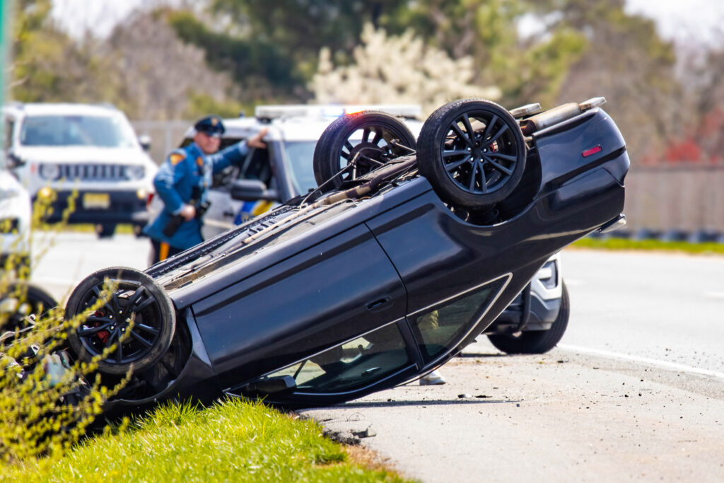 Why Choose an MRI Over an X-Ray After a Car Accident