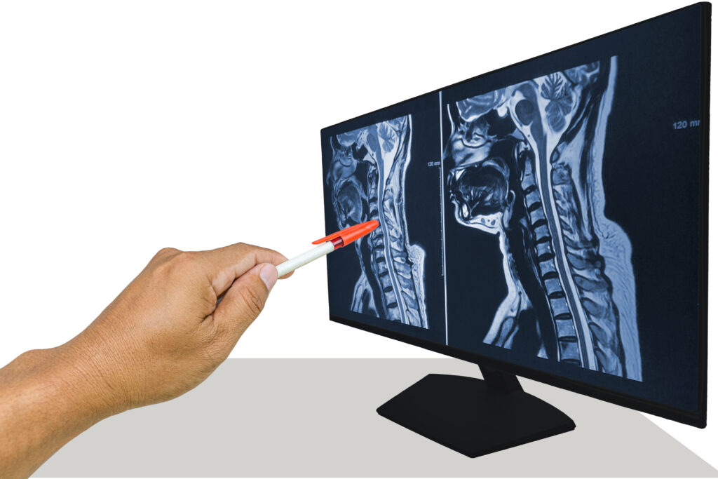 Diagnostic Imaging After an Accident or Injury | Precision MRI