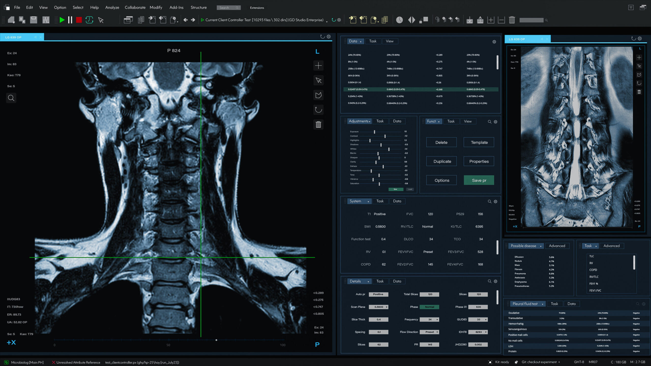 Open MRI for Sports Injuries: A Comprehensive Diagnostic Approach | Precision MRI Group