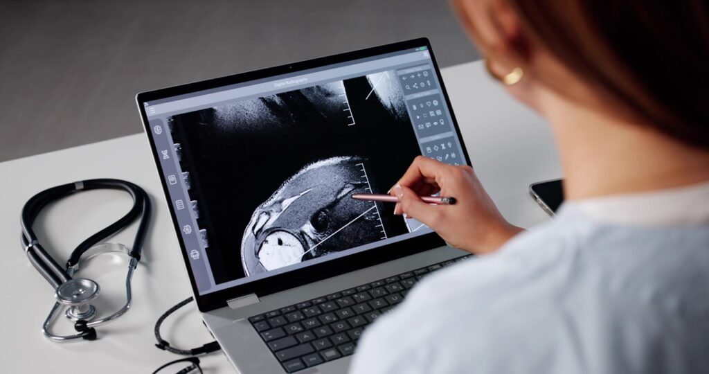 Shoulder MRI Cypress Creek: Diagnose Pain, Rotator Cuff Tears | Precision MRI Group