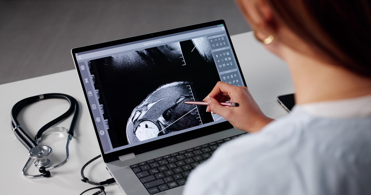 Shoulder MRI Cypress Creek: Diagnose Pain, Rotator Cuff Tears | Precision MRI Group