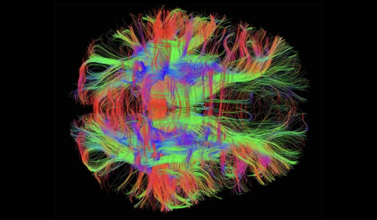 Diffusion Tensor Imaging